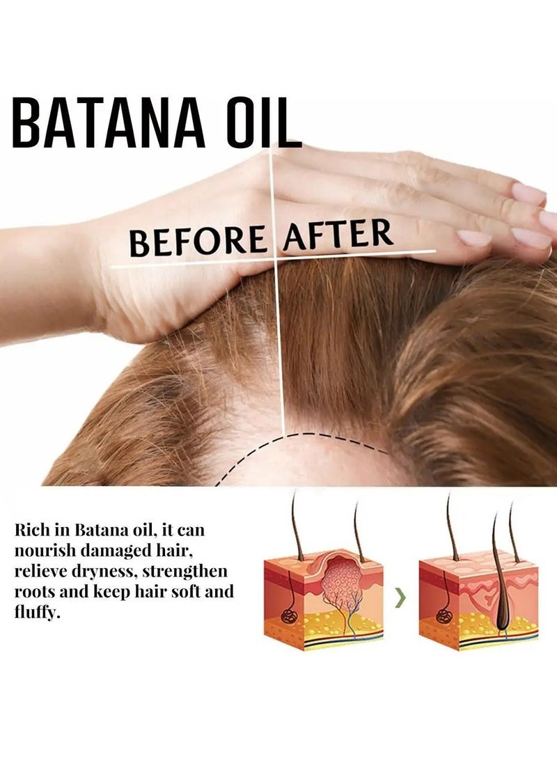AS SEEN ON TV - Batana Oil For Hair Growth, Natural And Safe Nourishing Hair Care Oil,  Moisturizing Batana Oil Butter For Hair Loss Treatments, Organic Hair Growth Essence For All Hair Types, (B 20ml) - Image 1