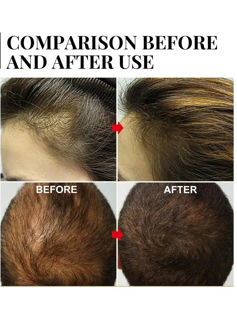 AS SEEN ON TV - Batana Oil For Hair Growth, Natural And Safe Nourishing Hair Care Oil,  Moisturizing Batana Oil Butter For Hair Loss Treatments, Organic Hair Growth Essence For All Hair Types, (B 20ml) - Image 1