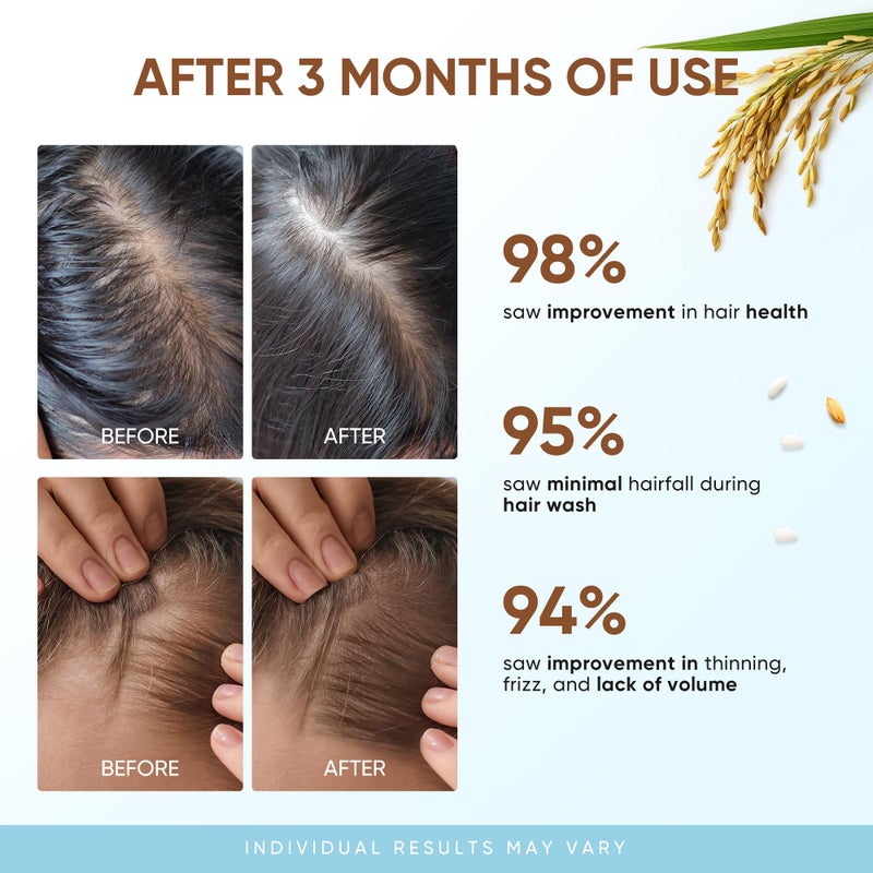 Svvimer Rice Water Hair Growth Shampoo - Thickening Shampoo with Biotin for Hair Loss and Thinning Hair - Image 4