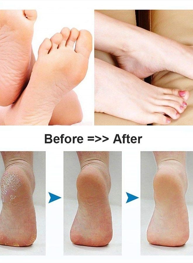 BOMPOW Foot Scrubber Electric Callus Remover Rechargeable Foot File Hard Skin Remover Pedicure Tools Electronic Callus kit for Cracked Heels and Dead Skin with 2 Roller Heads, Blue - Image 3