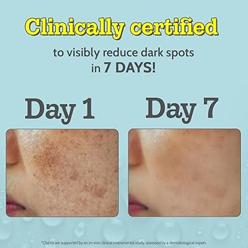 Chemist At Play 10 Vitamin C Face Serum Brightens Gives Glow Fades Dark Spots Treats Hyperpigmentation Balances Melanin Production Ethyl Ascorbic Acid Glucosamine For All Skin Types 30ml - Image 3