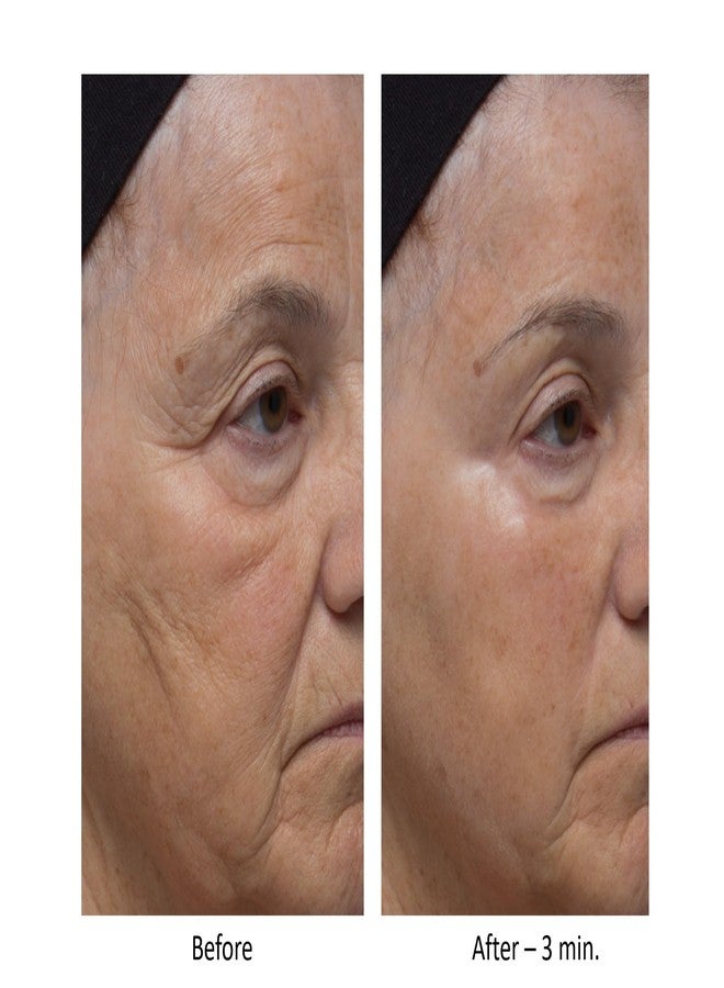 Dr. Denese Wrinkle Lost Line Reducer, 3 Minute Age Eraser With Silk Protein Fiber Technology - Image 3