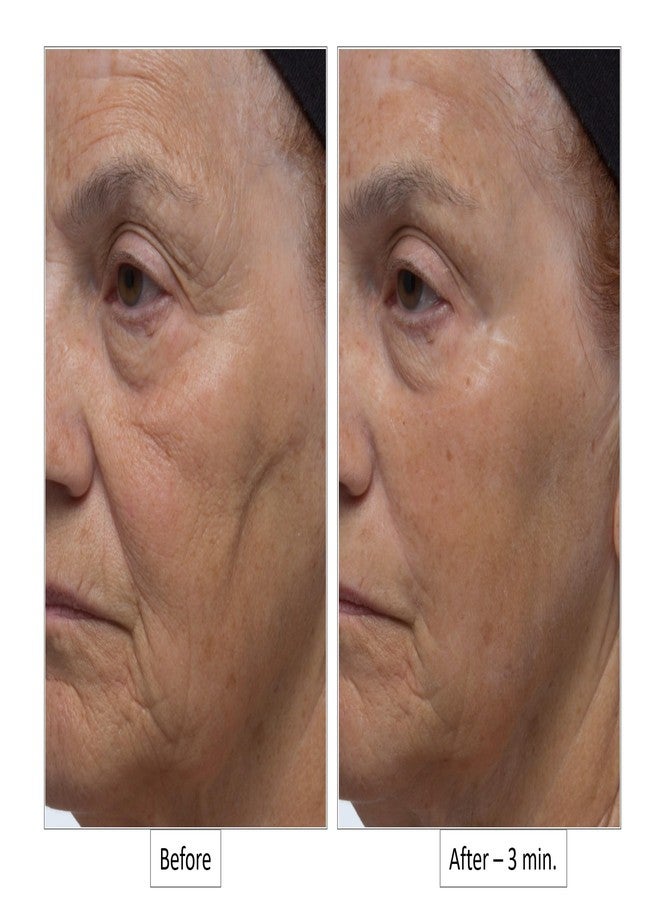 Dr. Denese Wrinkle Lost Line Reducer, 3 Minute Age Eraser With Silk Protein Fiber Technology - Image 4