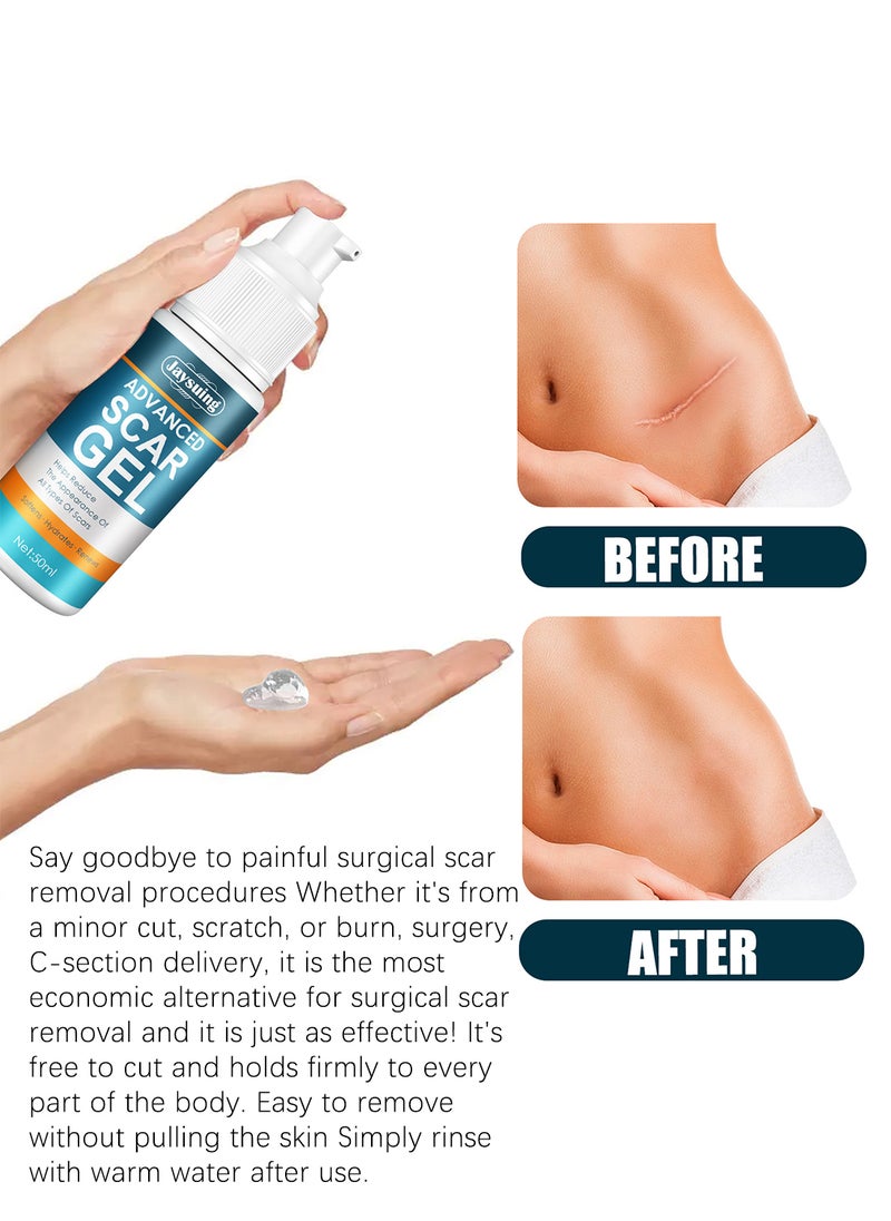 Jaysuing - Advanced Scar Gel, 100% Silicone Scar Gel, Scar Removal Cream, Suitable for Scars, Stretch Marks, Acne, Burns, Hypertrophic Scars, Old and New Scars 50ml - Image 1