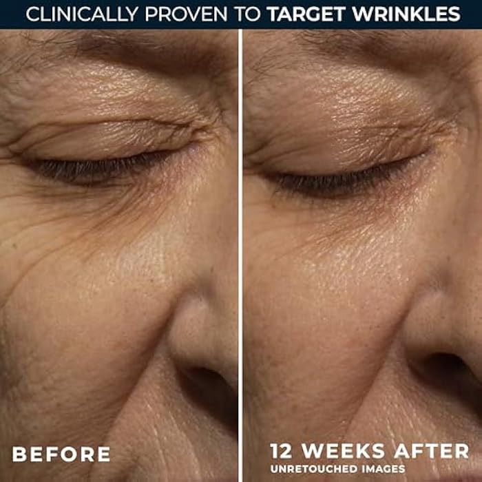 RoC Retinol Correxion Deep Wrinkle Anti-Aging Night Cream, Daily Face Moisturizer with Shea Butter, Glycolic Acid and Squalane, Skin Care Treatment, Mini 0.5 Ounces (Packaging May Vary) - Image 4