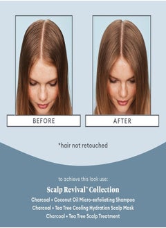 Briogeo Briogeo Scalp Revival Charcoal + Tea Tree Scalp Treatment Serum 30ml Detoxify & Soothe Scalp for Healthier Hair  - Image 3