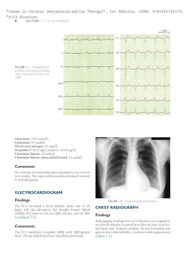 Cases in Cardiac Resynchronization Therapy: Expert Consult - Online and Print  - Image 3