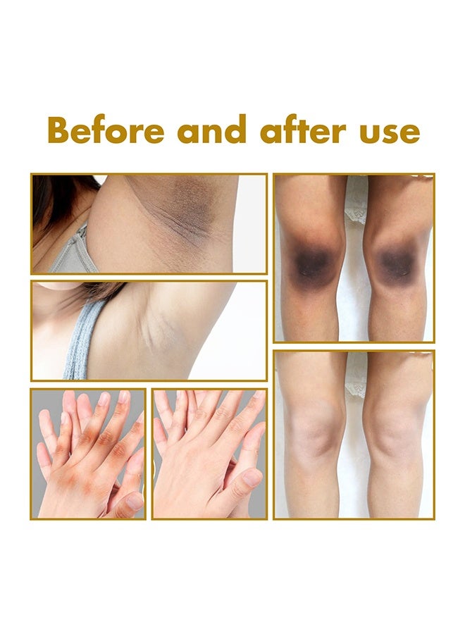 West&Month Peeling Plus-Acanthosis NigricansRremoval Oil,Dark Spot Corrector Oil, Acanthosis Nigricans Treatment For Dark Knuckle Finger Elbow And Knee Removal 50ML - Image 3