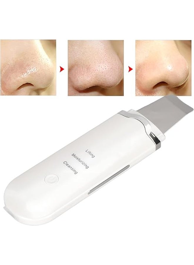 جهاز تنظيف وتقشير الوجه العميق بالموجات فوق الصوتية | سكراب لإزالة الرؤوس السوداء والدهون وشد البشرة | 3 في 1 (تنظيف، ترطيب، رفع) | أداة علاج المسام وتفتيح الوجه قابلة لإعادة الشحن - Image 4