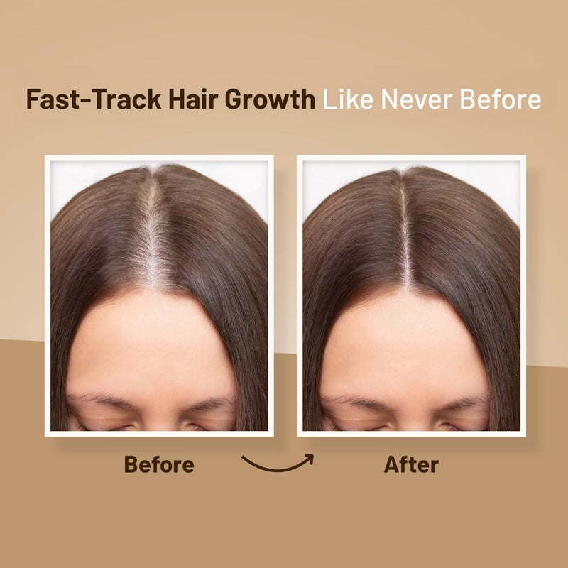 Herbishh Thickening Shampoo and Conditioner | Hair Vitalizer | Hair Growth Essence Oil | Prevents Hair Loss - Supports Healthy Growth (4in1) - Image 4