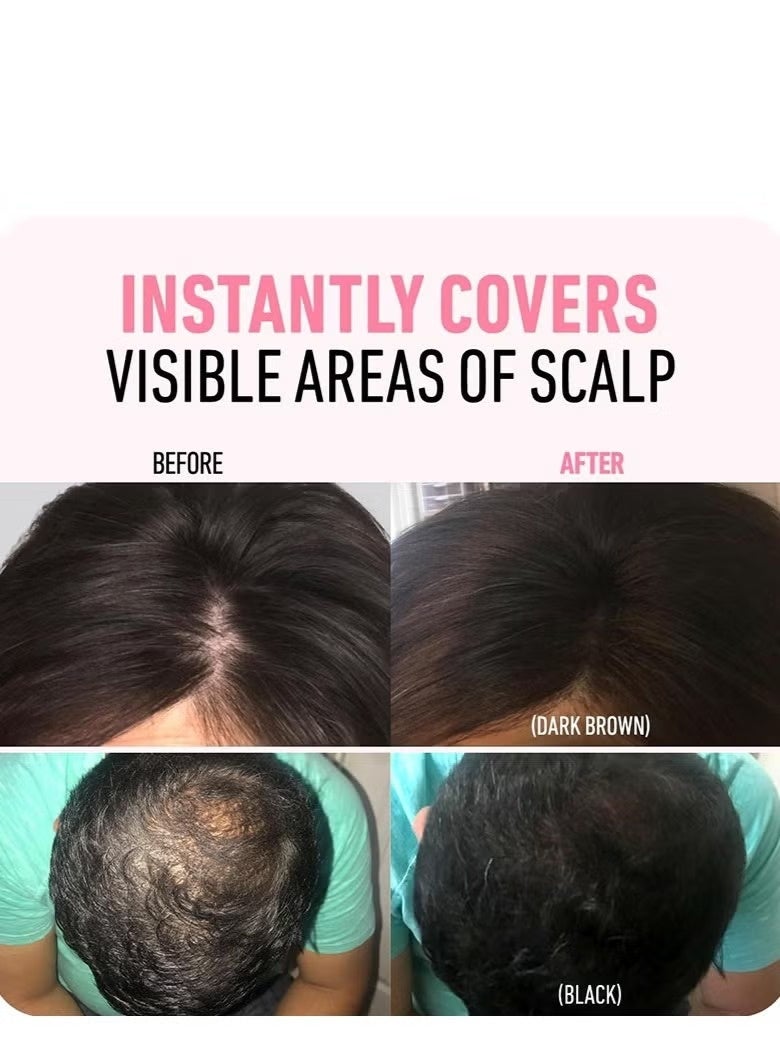 Hairbear Hair Filler,Hairline Shadow Powder,Hairline Powder Instantly Conceals,Instant Volume&scalp Coverage for Thinning Hair,Fast & Full Care, 100% Water Sweat Resistant ( Black) - Image 4