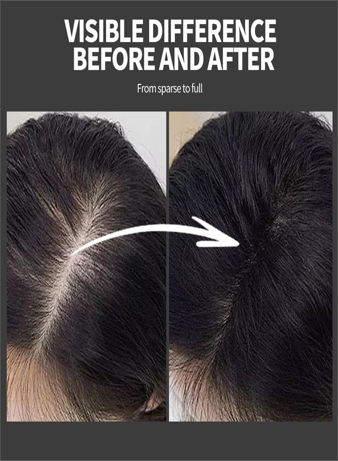 LEWEDO Hair Building Fibers 25G with Precision Spray Applicator - Electrostatic Adsorption for Instant Thicker Hair, Waterproof & Natural Look, Suitable for Men & Women​ (Black) - Image 5