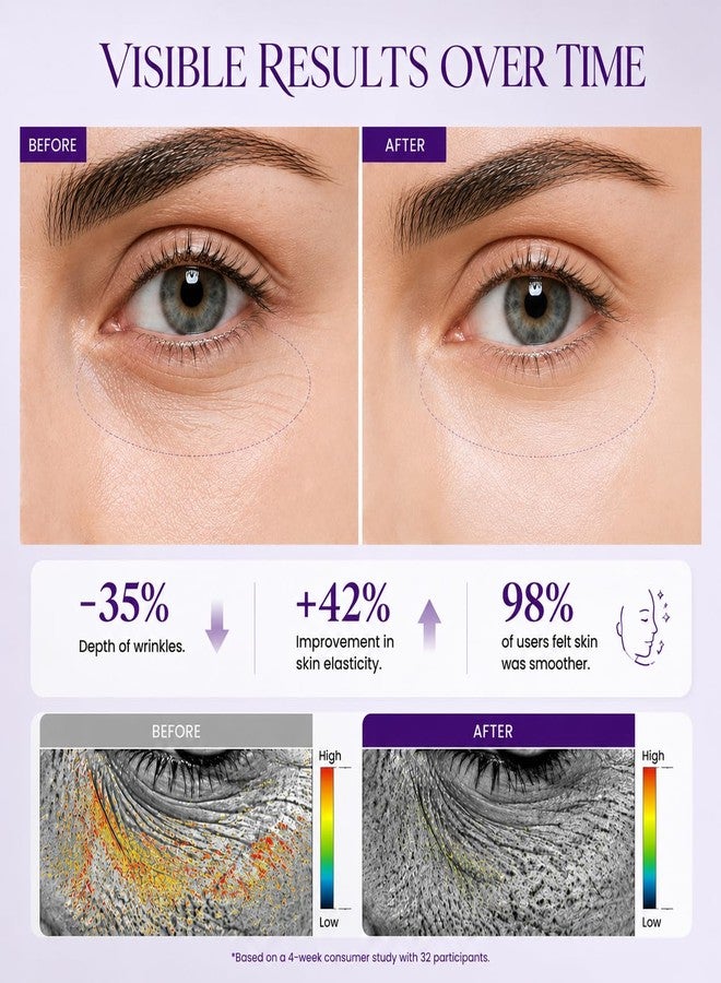 Veakoo Retinol Eye Cream, Anti-Aging Under Eye Care for Dark Circles & Puffiness - Image 4