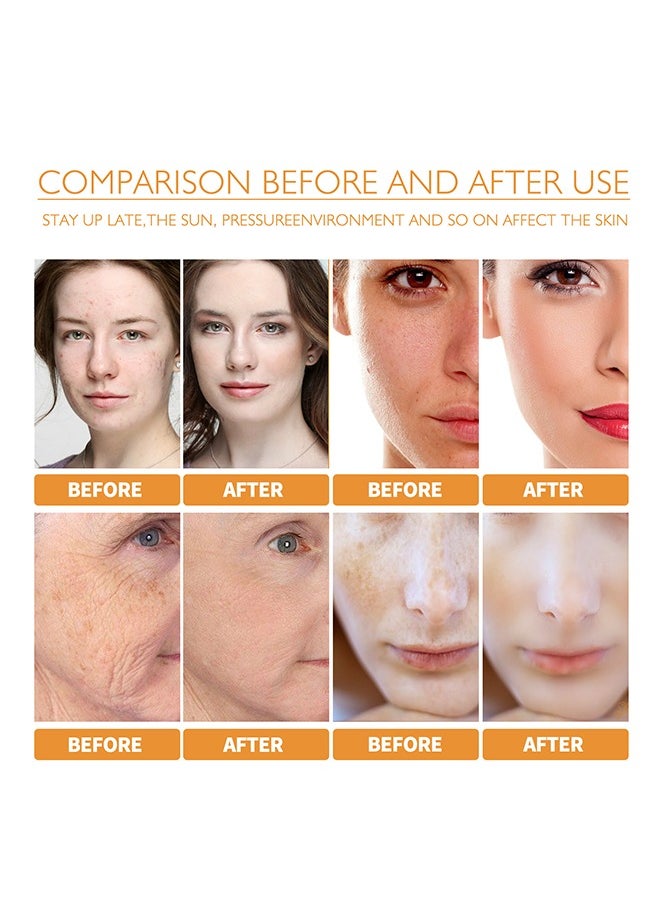 West&Month - Turmeric Anti-Oxidation Face Serum,Dark Spot Corrector Serum,Bright Skin Dark Spot Corrector Face Whitening Serum, Hydrate Dull And Dry Skin 30ML - Image 1