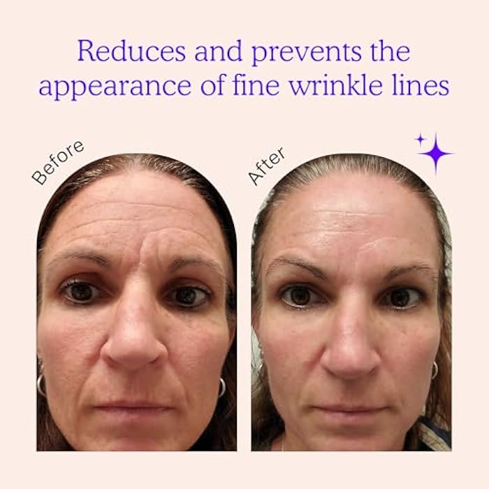BLUMBODY Face, Forehead Wrinkle Patches - Anti Wrinkle Facial Patches to Smooth Eye, Mouth, Forehead Wrinkles - Non-Silicone Face Tape for Fine Wrinkles between Eyes, Face - Patches (30 day supply) - Image 2