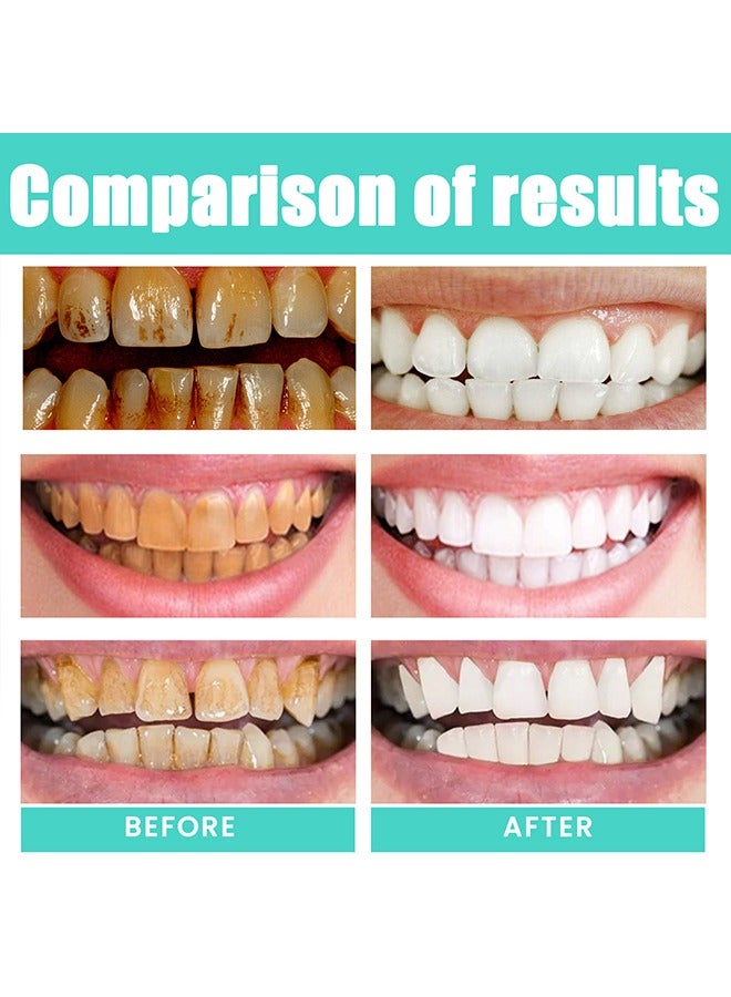 ORALHOE Whitening Mouth Wash,Coconut & Peppermint Oil with Tongue Scraper Inside the Box - Natural, Alcohol Free Mouthwash to Help With Fresh Breath, Teeth Whitening and Healthier Teeth & Gums 100ml - Image 5