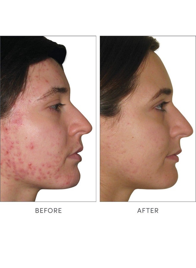 Jane Iredale برنامج التغذية المتقدمة مكمل سكين أكومكس موزع بواسطة جين إيردال، إمداد لمدة 30 يومًا - Image 3