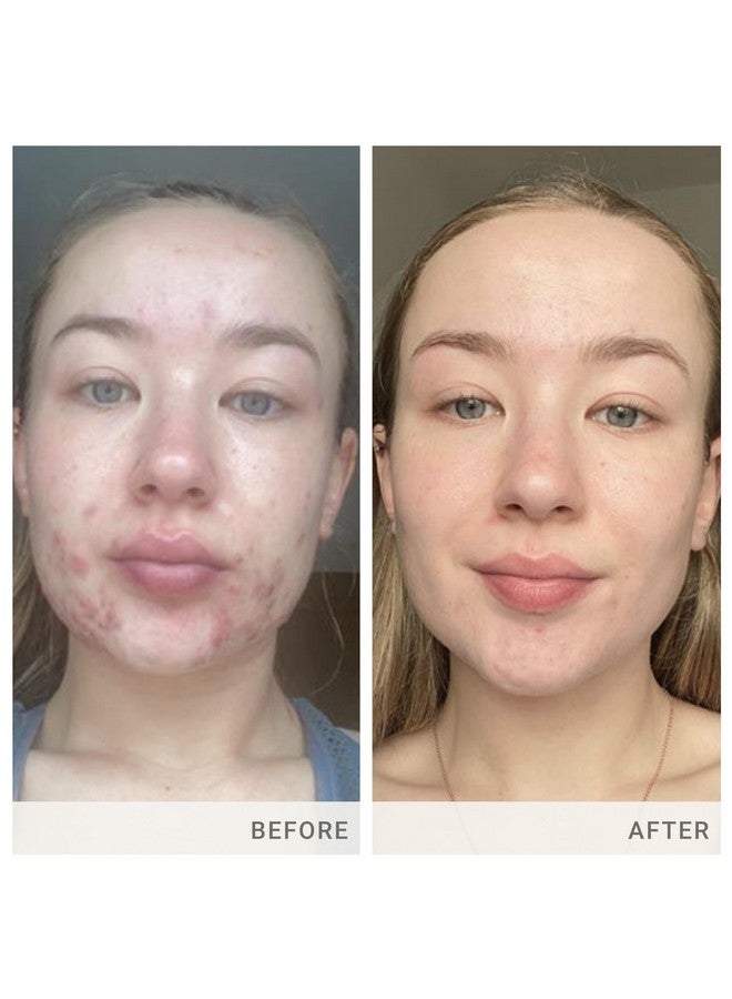 Jane Iredale برنامج التغذية المتقدمة مكمل سكين أكومكس موزع بواسطة جين إيردال، إمداد لمدة 30 يومًا - Image 4