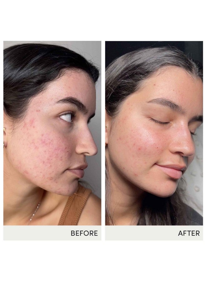 Jane Iredale برنامج التغذية المتقدمة مكمل سكين أكومكس موزع بواسطة جين إيردال، إمداد لمدة 30 يومًا - Image 5