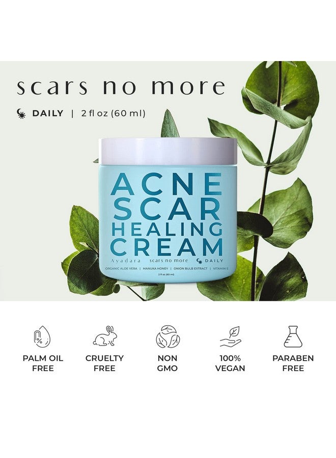 AYADARA Acne Scar Healing Cream, 2 Fl Oz, Acne Scar Treatment For Face, Stretch Marks, Body Scars, Acne Scar Removal Cream For Body, Acne Scar Remover For Cuts And Burns, For All Skin Types, 200+ Uses - Image 3