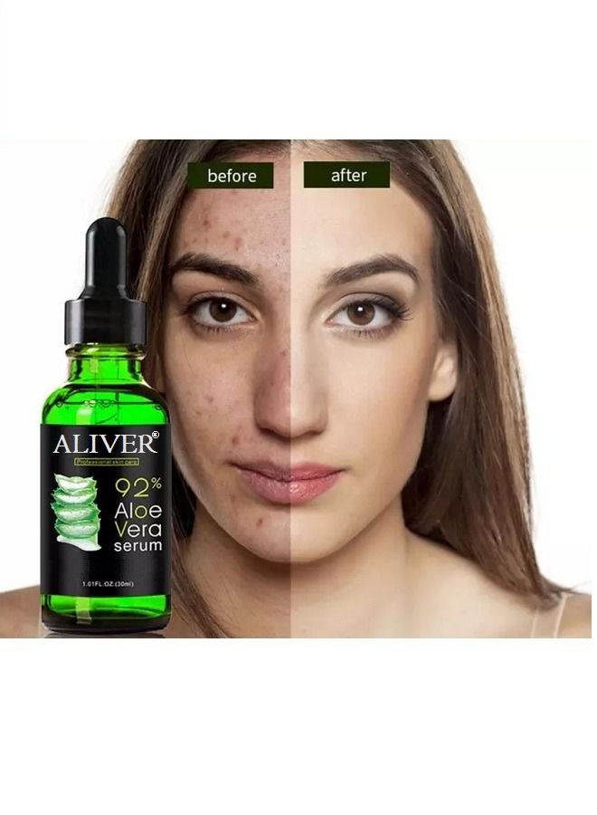 ALIVER 99% Natural Aloe Vera Serum 30ml 30ml - Image 3
