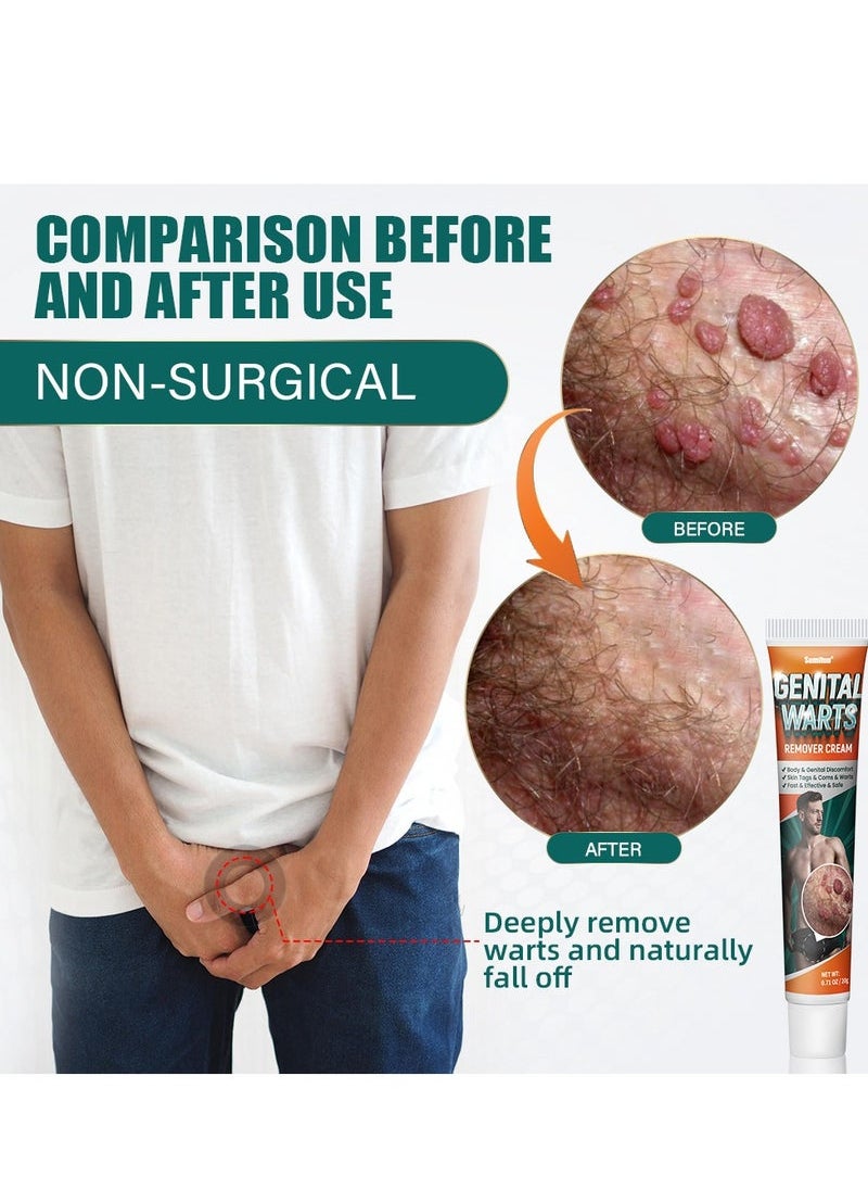 Sumifun Wart Removal Cream, A Gentle Safe Portable Wart Removal Cream with Natural Extracts for All Skin Types，Universal for Both Men and Women Wart Removal .Protecting Health and Beauty.  - Image 2