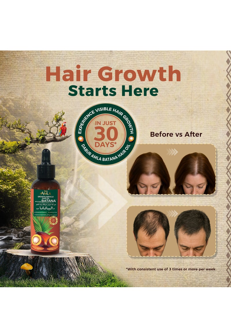 دابر زيت الشعر دابر أملا بيور باتانا معجزة النمو – 95 مل | مع 100% من الباتانا الخام وفيتامين هـ | يعزز نمو الشعر، ويمنع تساقط الشعر ورققه، ويحسن النعومة ويعزز اللمعان | مصدرها أخلاقيا من هندوراس | مناسبة لكل من النساء والرجال - Image 3