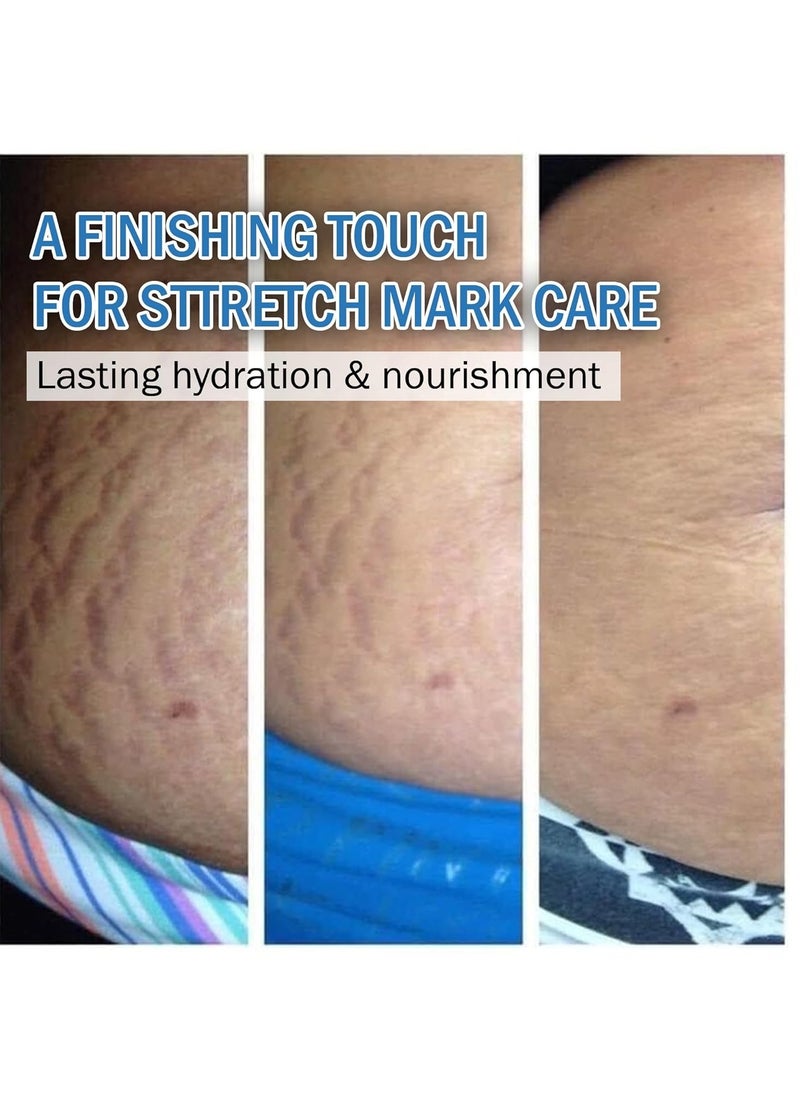 7 Days 7 DAYS Stretch Marks Oil For Women, Stretch Mark Cream For Pregnancy 30 ml (Pack of 1)  - Image 4