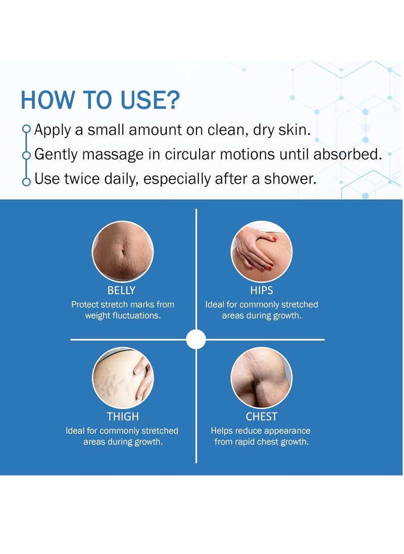 7 Days 7 DAYS Stretch Marks Oil For Women, Stretch Mark Cream For Pregnancy 30 ml (Pack of 1)  - Image 3