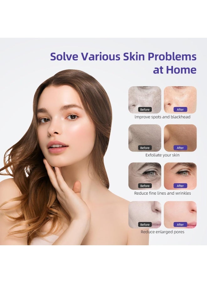 جهاز صنفرة الجلد الدقيقة الماسية 3 في 1، جهاز صنفرة الجلد الاحترافي لتقشير البشرة وشد التجاعيد وإزالة الرؤوس السوداء، معدات شخصية للاستخدام المنزلي للعناية ببشرة الوجه، LB112B (أبيض) - Image 2