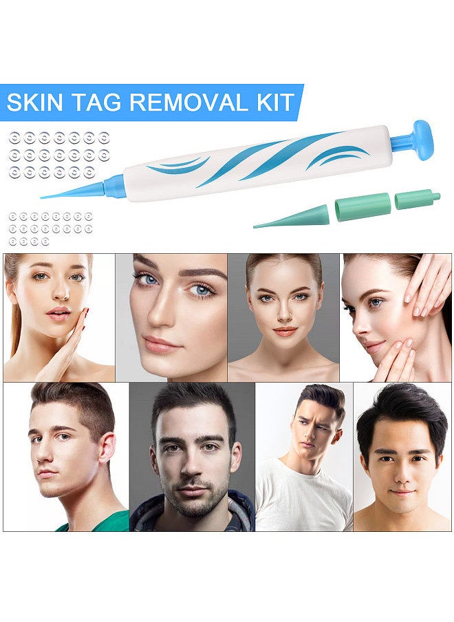 Generic - Remove Skin Tag Pen Two in One Facial Care Nevus Tool 2mm-8mm Remove Meat Nevus Corns Warts Skin Tag Removal Tool Replaceable head - Image 1