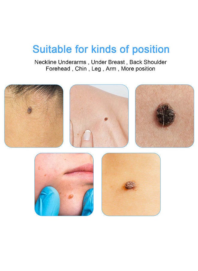 Generic - Remove Skin Tag Pen Two in One Facial Care Nevus Tool 2mm-8mm Remove Meat Nevus Corns Warts Skin Tag Removal Tool Replaceable head - Image 1