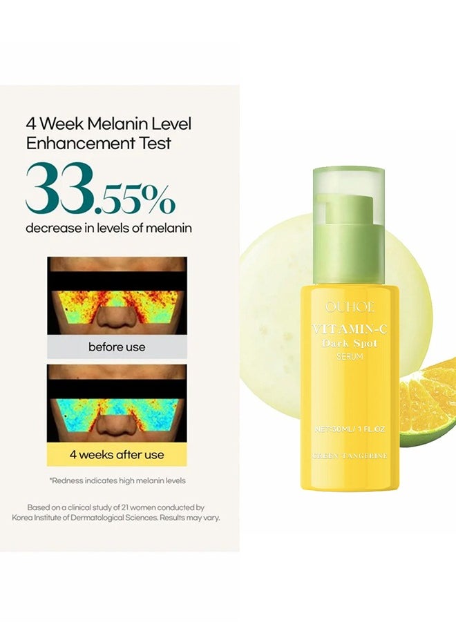 OUHOE - Vitamin C Dark Spot Serum,Niacinamide acid Help Fade Sun Spots and Dark Spot,For Face & Neck and Eye Care Organic Anti-Aging Serum (30ml) - Image 1
