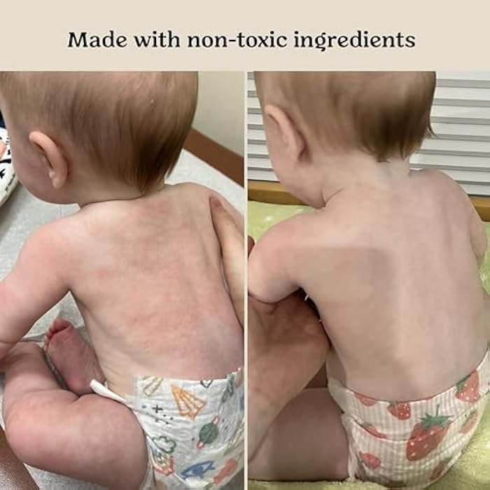Roe Wellness- Baby Serum Hydrating Skincare EWG Verified Non-Toxic Ingredients Probiotic Protection | Hydrate, Soothe, Safe For All Skin Babies, Infants, Toddlers & Kids (Power Serum) - Image 4
