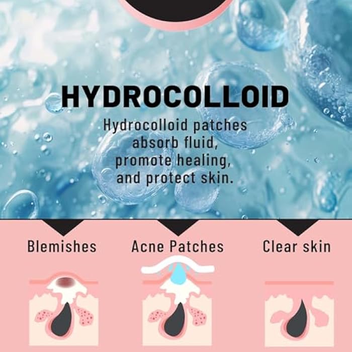TOLEVITA Hydrocolloid Acne Patches for Face | Blemish and Zit Covering Patches for All Skin Types | Pimple Spot Stickers for Clear Skin | Waterproof, Invisible Patches for Day & Night Use - 36 Pcs - Image 3
