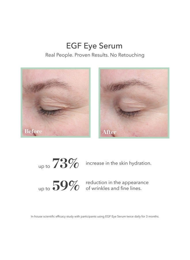 BIOEFFECT EGF Eye Serum with De-Puffer Rollerball, Anti-Aging, Moisturizing Contour Gel To Visibly Reduce Wrinkles, Puffiness, Fine Lines with Barley Growth-Factor Protein - Image 2