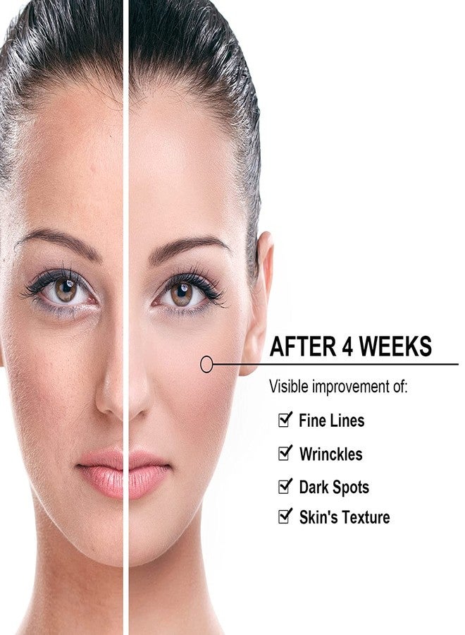 Elitzia Carbon Gel Peel Skin Care Rejuvenation Black Doll Facial Skin Deep Cleaning with Nano Activated Carbon for Laser Carbon Cream ETBDF80 80ml Pack of 2 - Image 3
