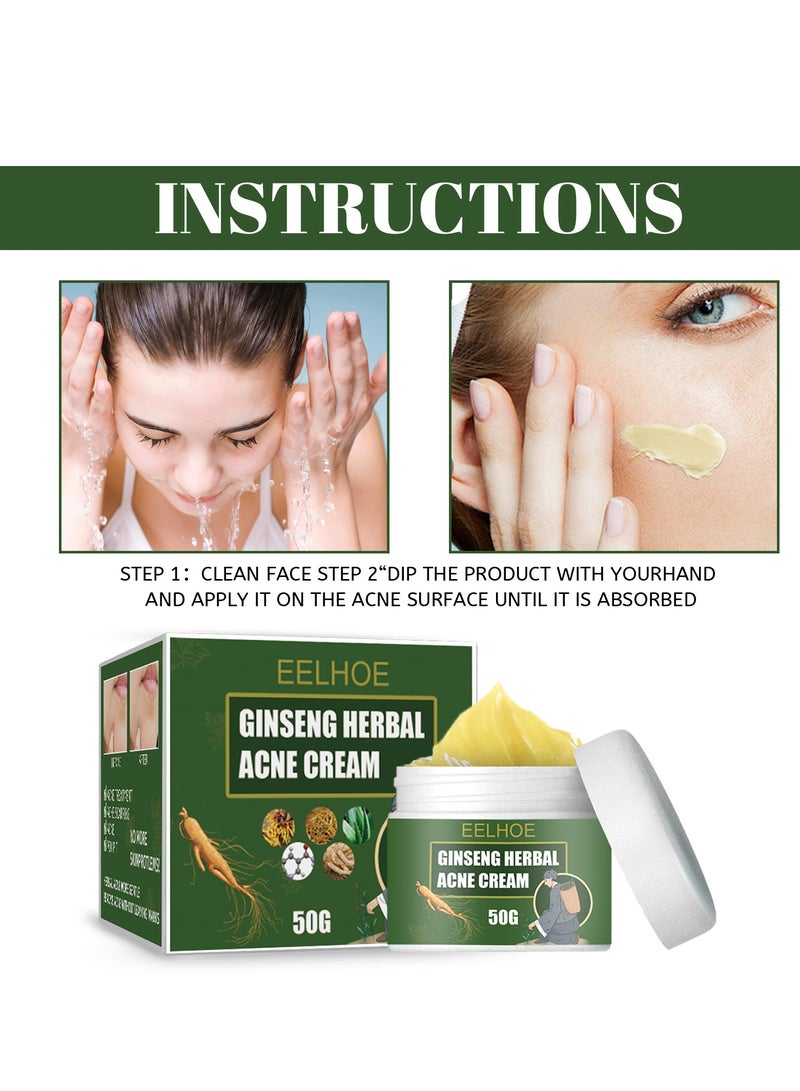 إيلهو كريم علاج حب الشباب ، كريم حب الشباب في الوجه ، كريم حب الشباب الموضعي وأدوية جل حب الشباب ، كريم حب الشباب البنزويل بيروكسيد 5٪ مع زيت شجرة الشاي لحب الشباب في الوجه 50 جم - Image 4