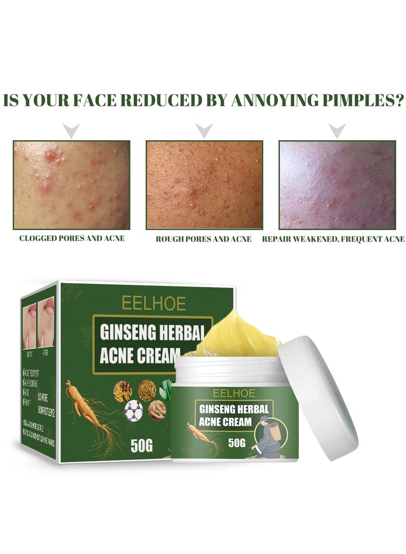 إيلهو كريم علاج حب الشباب ، كريم حب الشباب في الوجه ، كريم حب الشباب الموضعي وأدوية جل حب الشباب ، كريم حب الشباب البنزويل بيروكسيد 5٪ مع زيت شجرة الشاي لحب الشباب في الوجه 50 جم - Image 2