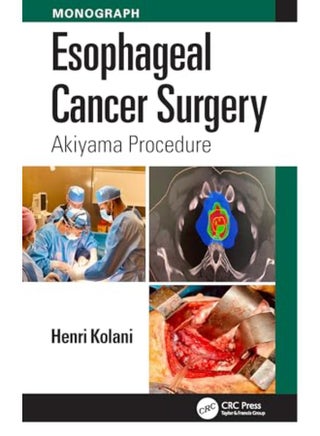 Esophageal Cancer Surgery - pzsku/Z89FC460B71D50802676EZ/45/_/1736944044/3df16b3d-157e-41e3-9799-39e63cd079b2