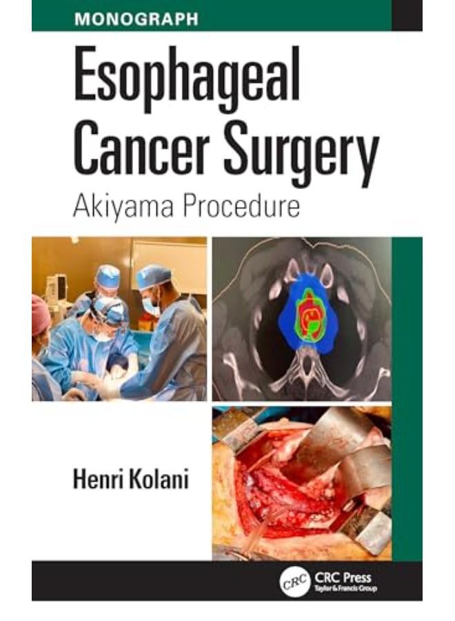 Esophageal Cancer Surgery