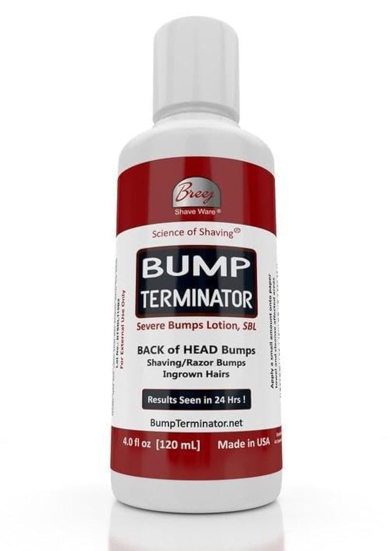 BUMP TERMINATOR Severe Bumps Treatment  Razor Bumps And Ingrown Hair Treatment  Bikini Bumps  Back of Head Bumps And Ingrown Hair Treatment 4 oz Pack of 1