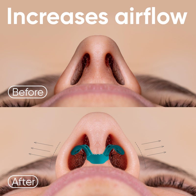 Brison Nasal Dilators for Breathing and Sleeping - 3 Pack Anti Snoring Nose Vents Opener for Better Breathing Sleeping and Activity Improves Airflow - Hard - Image 3