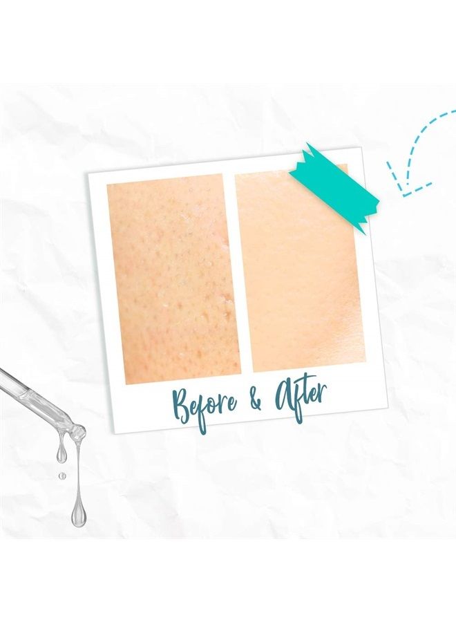 Bye Bye Blemish Skin Rescue Niacinamide Serum