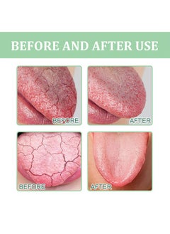 SOUTH MOON Fissured Tongue Relief Spray 8ml, Mint Freshener Mouth Spray, Bad Breath Spray, Breath Freshener Spray, Protected Mouth, Eliminating Bacteria and Odors, Pain Relief, Mouth Healthy Spray  - Image 4