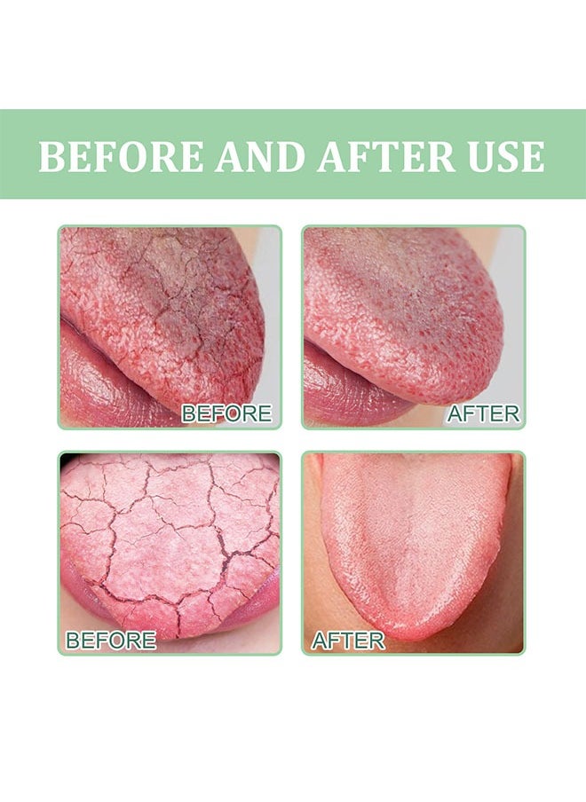 SOUTH MOON Fissured Tongue Relief Spray 8ml, Mint Freshener Mouth Spray, Bad Breath Spray, Breath Freshener Spray, Protected Mouth, Eliminating Bacteria and Odors, Pain Relief, Mouth Healthy Spray  - Image 4