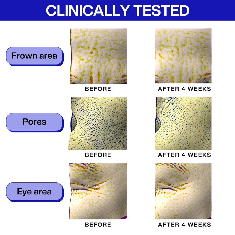 IOPE Retinol Super Bounce Serum | Korean Retinoid Eye Treatment for Anti-Aging, Beginner Friendly, Reduction in Fine Lines & Wrinkles, Firming and Rejuvenating, Daily Glow Routine, 1.69 Fl Oz. (50ml) - Image 2