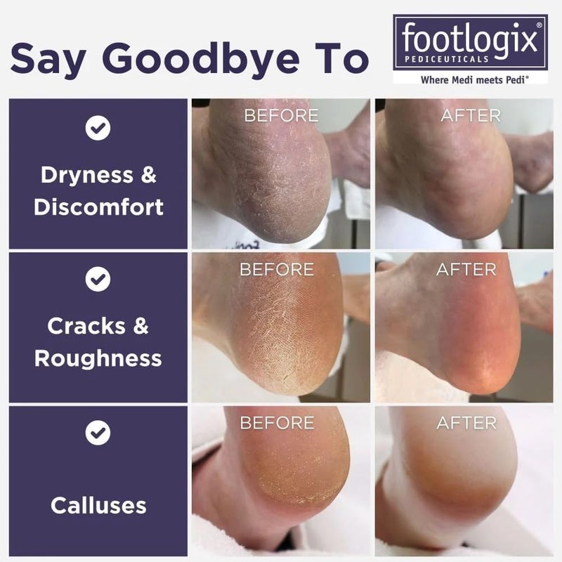 Footlogix مبرد مزدوج الجوانب مع مقبض مطاطي من فوتلوجكس - Image 2