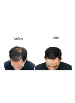 Dar Al Dawa Pack Of 3 Hairgrow 5% Minoxidil 3 Months Supply, 50Ml Each  - Image 3