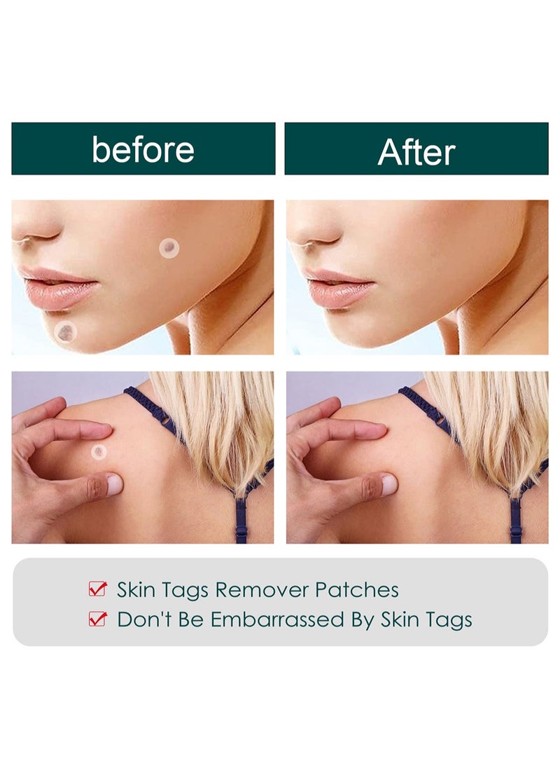 iBealee Skin Tag Patches for Mole & Wart Remover, Gentle and Effective Wart Removal Patches, Transparent Waterproof Easy to Use Skin Care Stickers, Suitable for all Skin Types, 144 Pcs  - Image 2